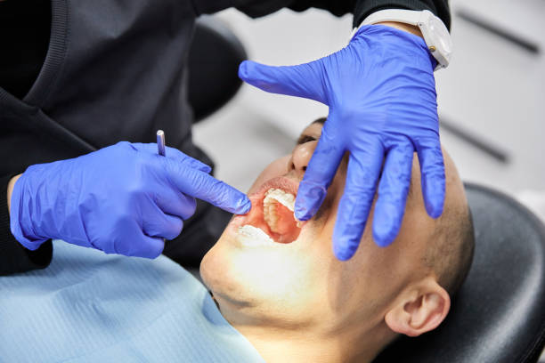 Best Emergency Treatment for Dental Infections or Abscesses in Guerneville, CA