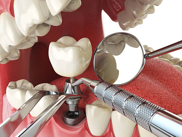 Best Pediatric Emergency Dentist in Guerneville, CA